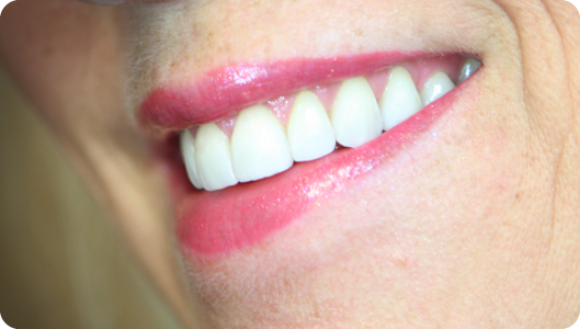 cosmetic dentistry